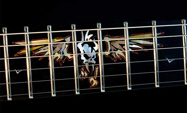 CUSTOM INLAYS